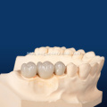 Customized Dental Porcelain Fused To Metal